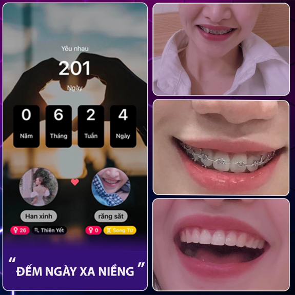 <b>Nguyễn Ngọc Hân </b>
<span>Niềng răng mắc cài kim loại </span>