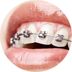 Ảnh thumb dịch vụ